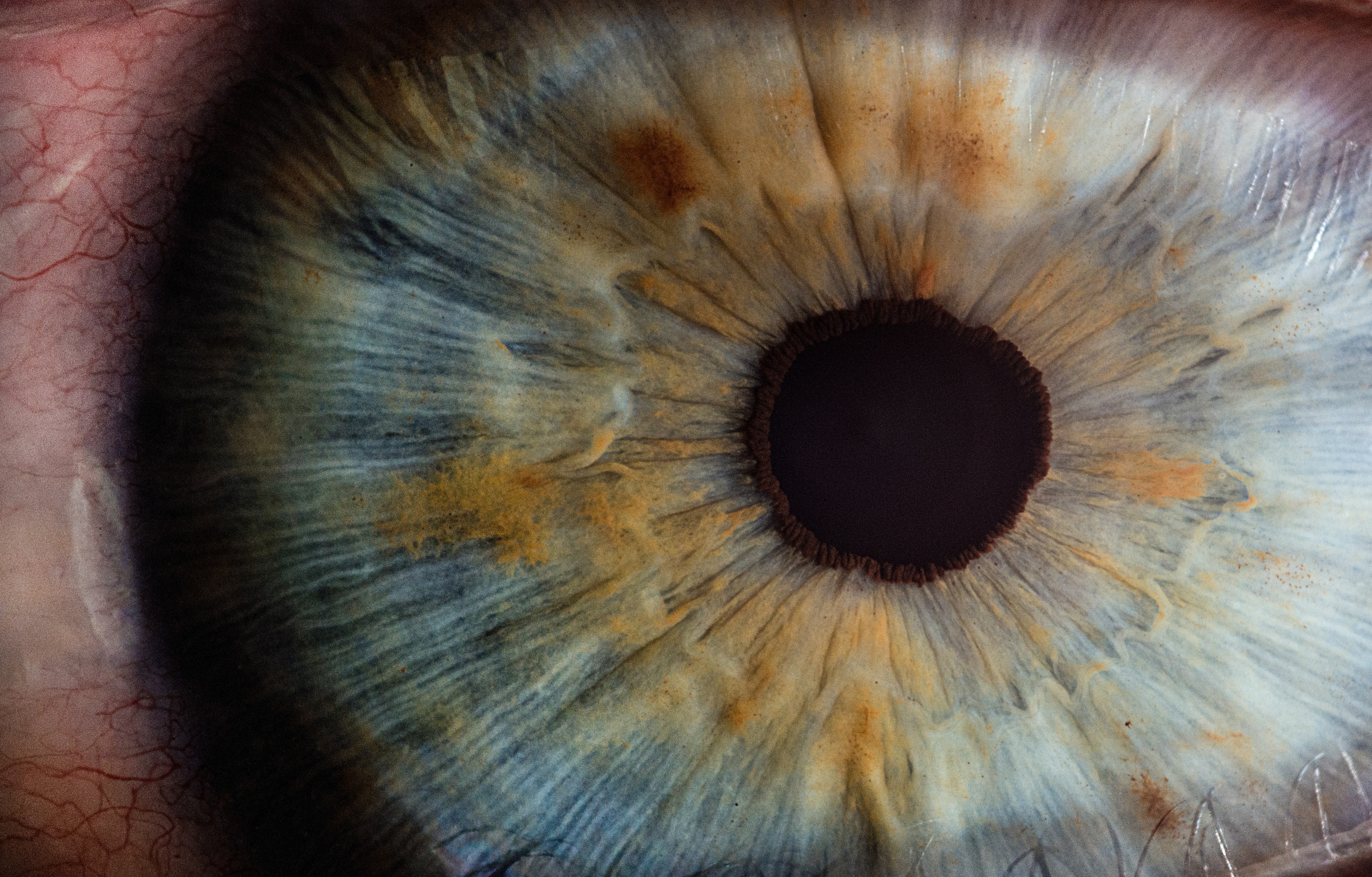 UF4219 - Anatomia e fisiologia do globo ocular